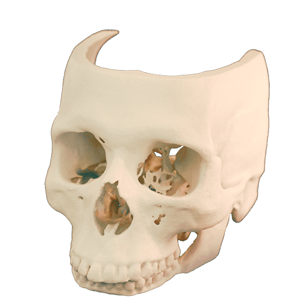 Médical